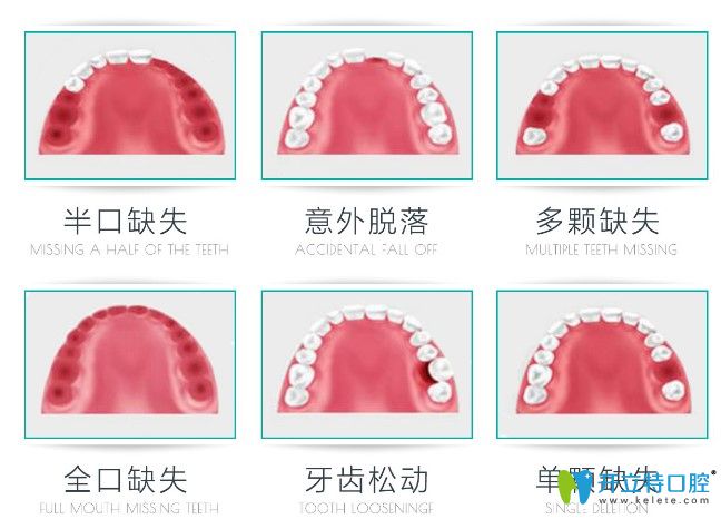福州哪個醫(yī)院種植牙比較好