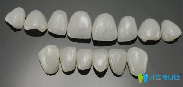 傳統(tǒng)瓷貼面介紹