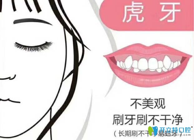 重慶維樂(lè)口腔陳瑤做牙齒矯正好不好