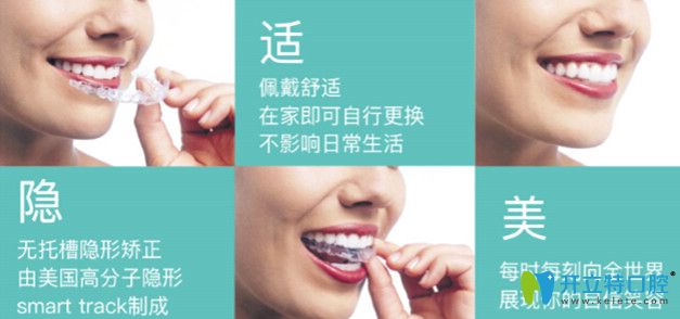 隱適美矯正的優(yōu)點(diǎn)