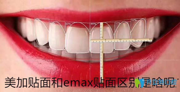 瓷貼面品牌千千萬，帶你了解美加貼面和emax貼面區(qū)別是啥