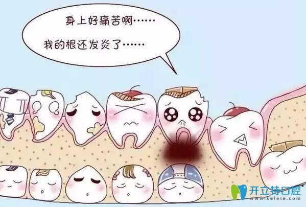 根尖周炎一定要及時(shí)就診