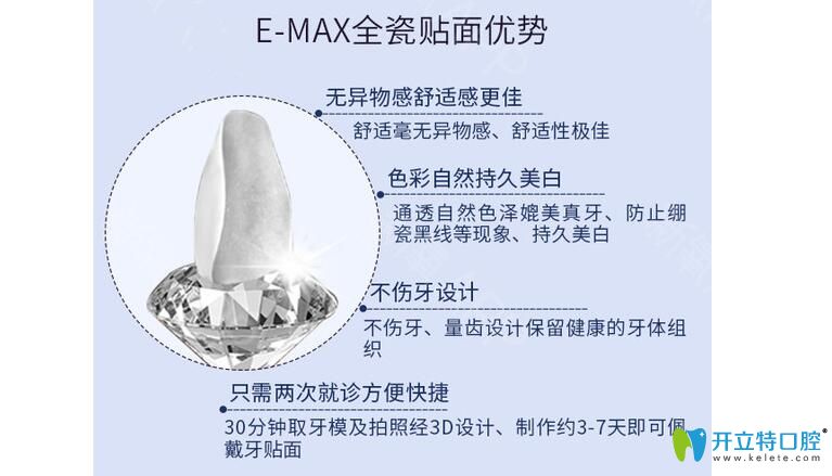 emax牙貼面優(yōu)勢介紹