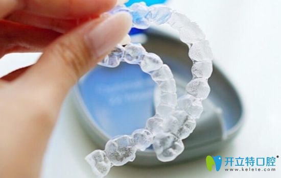 美國(guó)隱適美隱形矯正器價(jià)格雖高但物有所值 美國(guó)隱適美隱形矯正器價(jià)格雖高但物有所值