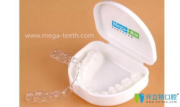 美加.易齊隱形矯正器展示圖 美加.易齊隱形矯正器展示圖