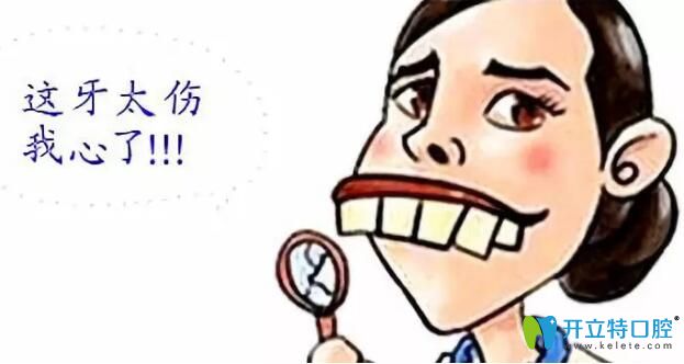 齙牙妹在鄭州卓越口腔做金屬自鎖托槽矯正后是這樣評(píng)價(jià)的