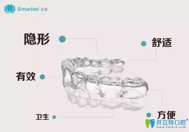 正雅隱形矯正牙套優(yōu)點