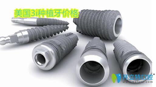 美國3i種植體費用