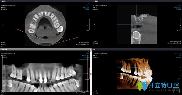 在陽(yáng)光樹(shù)口腔拍牙齒片子