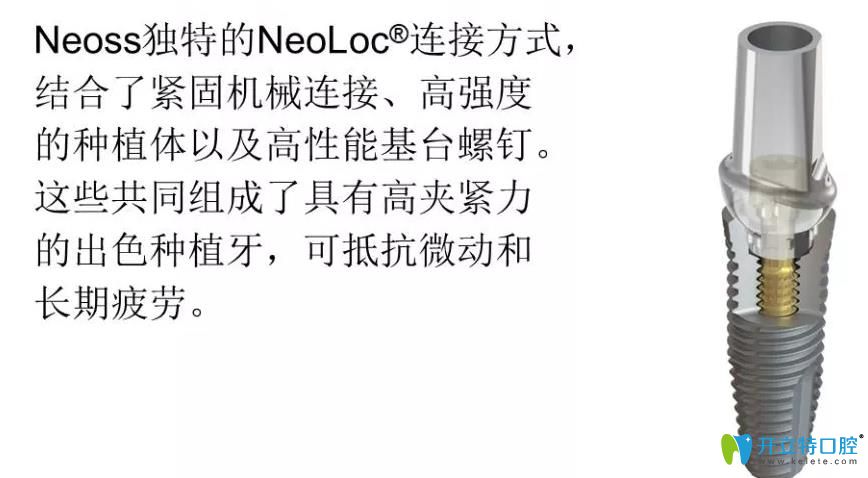 瑞典Neoss種植體優(yōu)勢(shì)