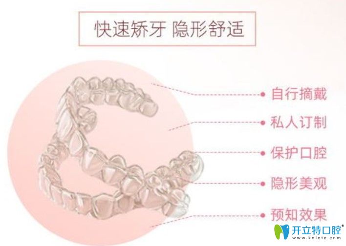 時(shí)代天使隱形矯正價(jià)格