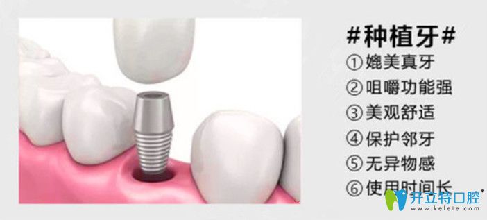 福州維樂口腔種植牙
