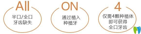 all-on-4種植牙技術(shù)