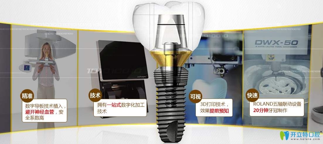 數(shù)字化種植牙