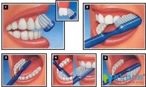 正確的刷牙方法