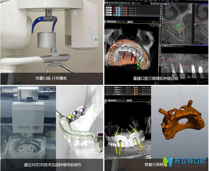 數(shù)字化種植過(guò)程