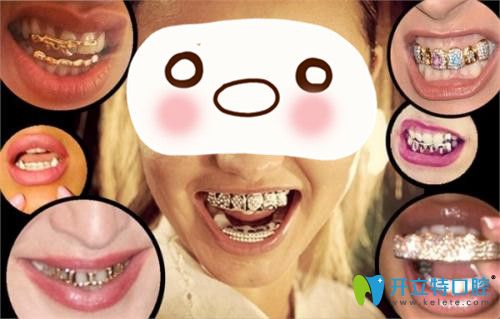 泰國的各種牙套