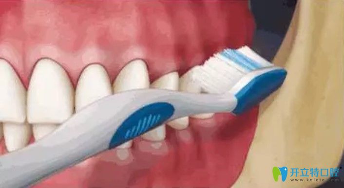 牙結(jié)石的危害有哪些