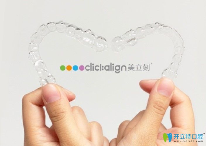分享美立刻隱形牙套的價格，剛做完虎牙矯正效果還不錯