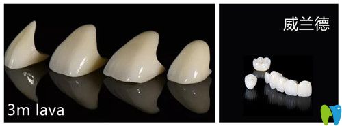 威蘭德和3M LAVA對比