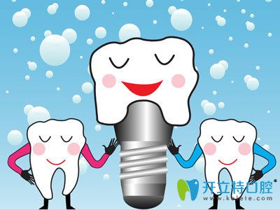 韓國(guó)種植體品牌排行