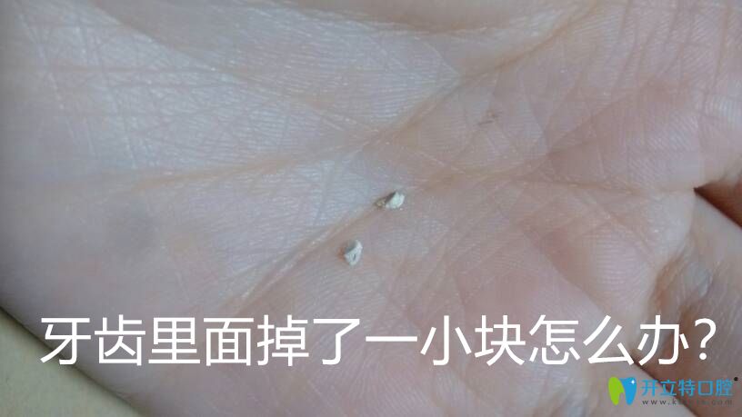 Duang！牙齒里面掉了一小塊怎么辦要補(bǔ)嗎