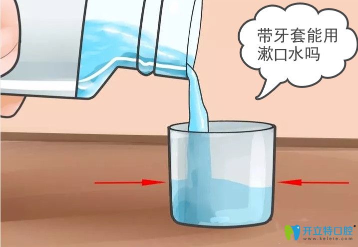 正畸帶了鋼牙套是不是要用漱口水？小姐姐們趕緊get起來(lái)吧