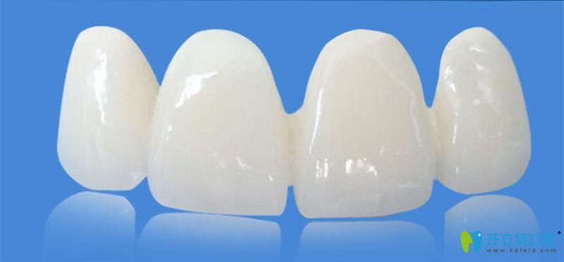 戳本文了解威蘭德zenostar和3m lava拉瓦全瓷牙哪個(gè)更好