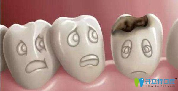 有了蛀牙后才想到牙科去補牙