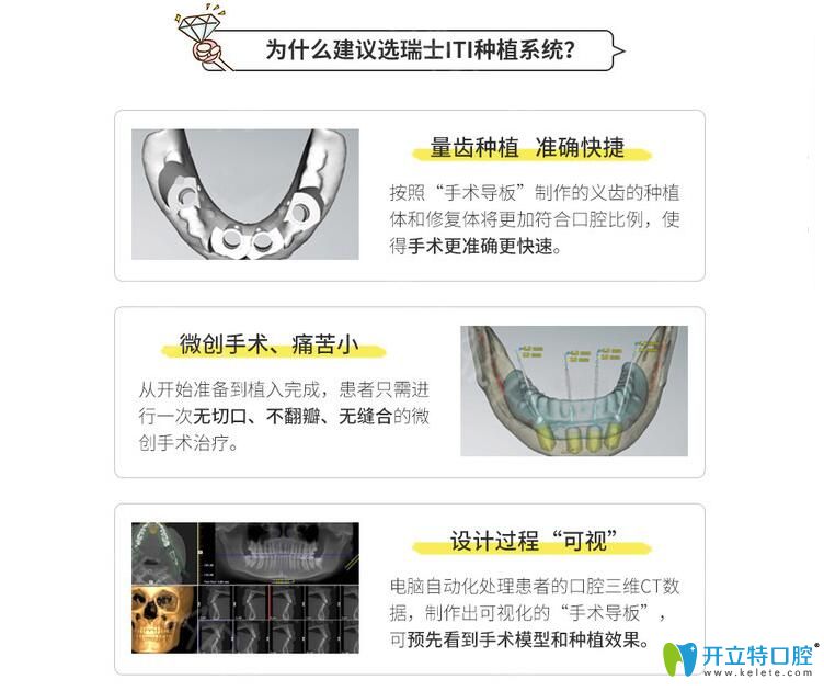 瑞士iti優(yōu)點介紹