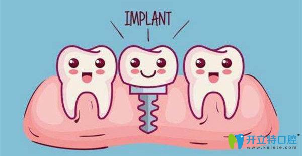種植牙的壽命掌握在自己手里