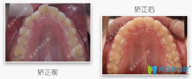 矯正時，選對醫(yī)生很重要