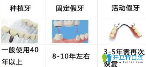 覆蓋義齒修復(fù)比種植牙價(jià)格便宜還比全口活動(dòng)假牙耐用