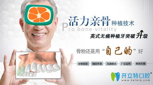 親骨種植牙優(yōu)勢介紹