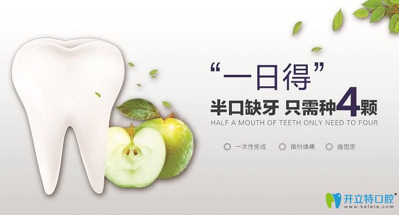 一日得種植牙半口缺失只種4顆