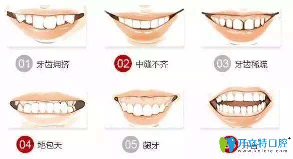 牙齒不齊的情況