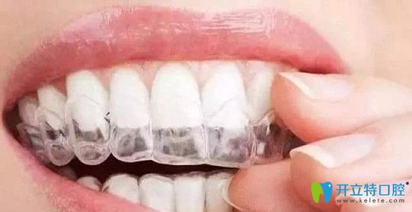 個別情況戴牙套是可以進(jìn)食的