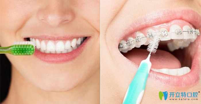飯后及時刷牙才能預(yù)防牙齒疾病
