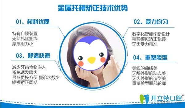 金屬矯正的優(yōu)勢(shì)