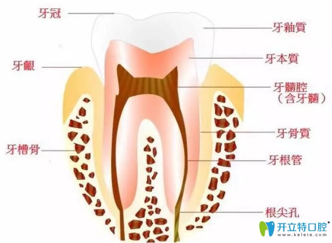 蛀牙修復醫(yī)生為啥建議我做根管治療而不是補牙呢？