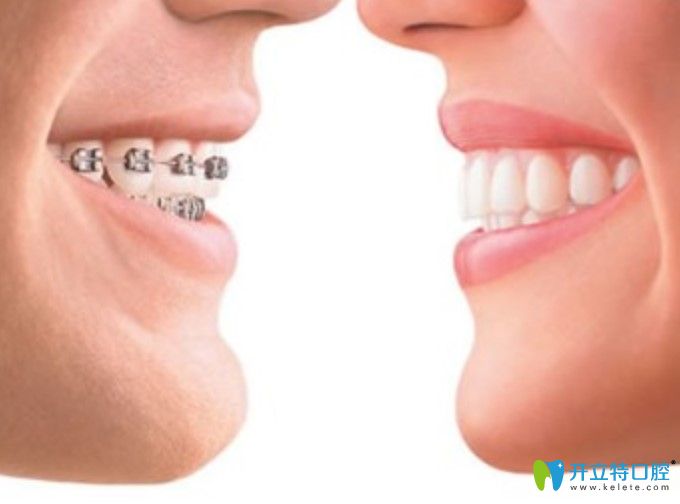 阜陽(yáng)壹加壹口腔中心王垚醫(yī)生解析：牙齒矯正到一般懷孕了怎么辦