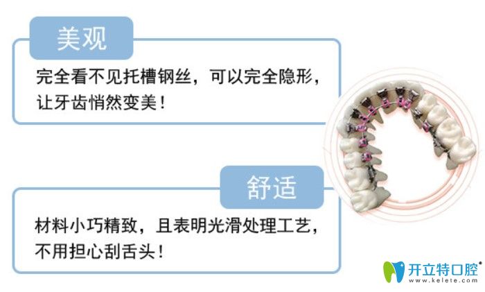 舌側(cè)隱形牙齒矯正的優(yōu)勢