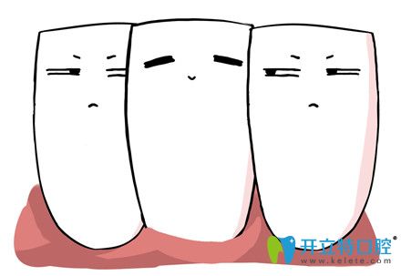 博世達(dá)牙齒矯正有用嗎