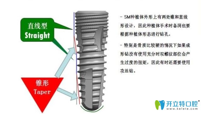 10秒時間讓你了解韓國dio種植體的型號及價格是怎樣的