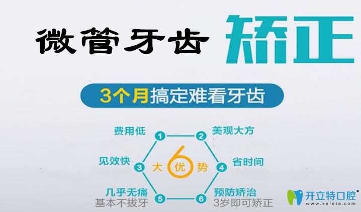 微管矯正牙齒這個(gè)新技術(shù)對單顆牙齒畸形的矯正效果杠杠滴