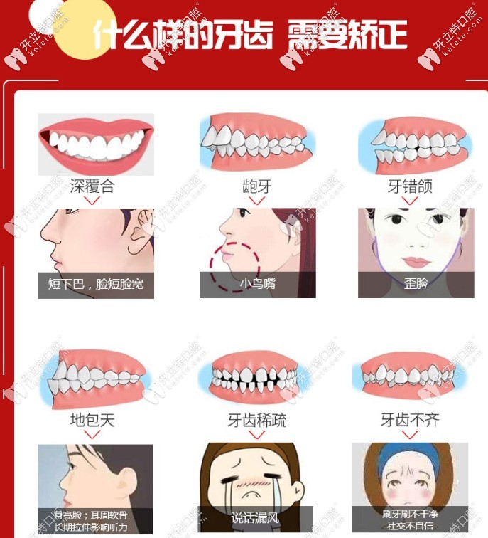 什么樣的牙齒需要矯正