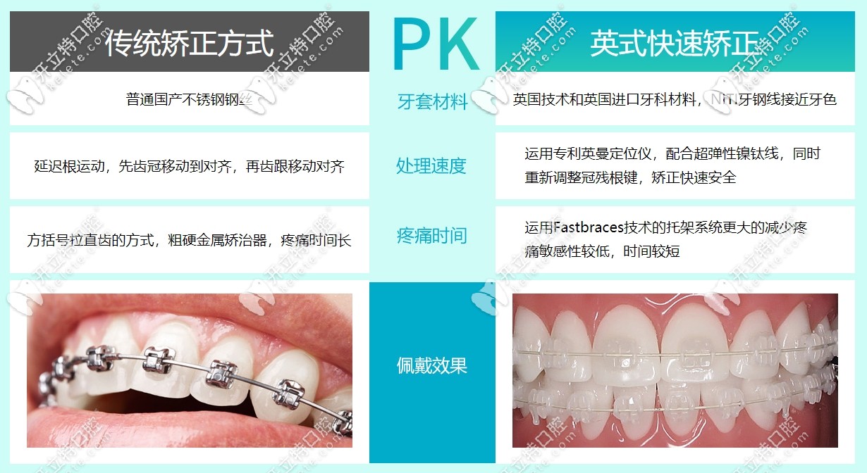 傳統(tǒng)矯正方式與英式快速矯正方式