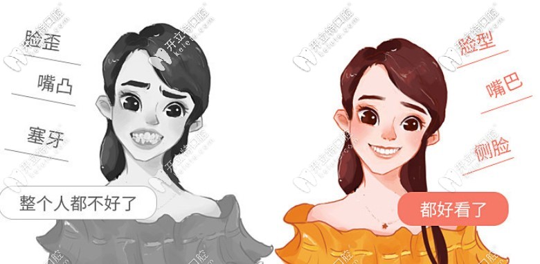 正畸“新玩法”，三場免費試戴隱形牙套的機會來啦~