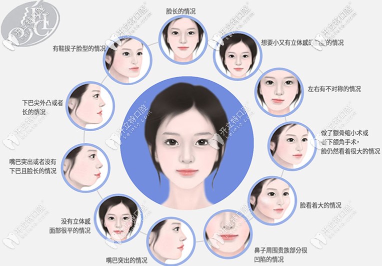 哪些情況適合做smart雙顎手術(shù) 哪些情況適合做smart雙顎手術(shù)