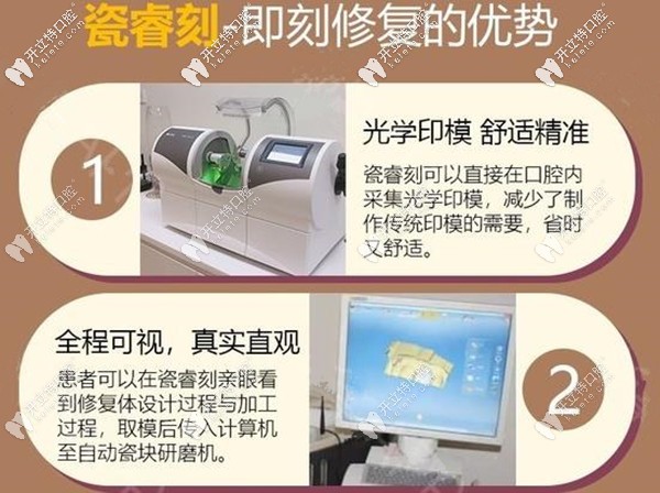 瓷睿刻即刻修復(fù)的優(yōu)勢